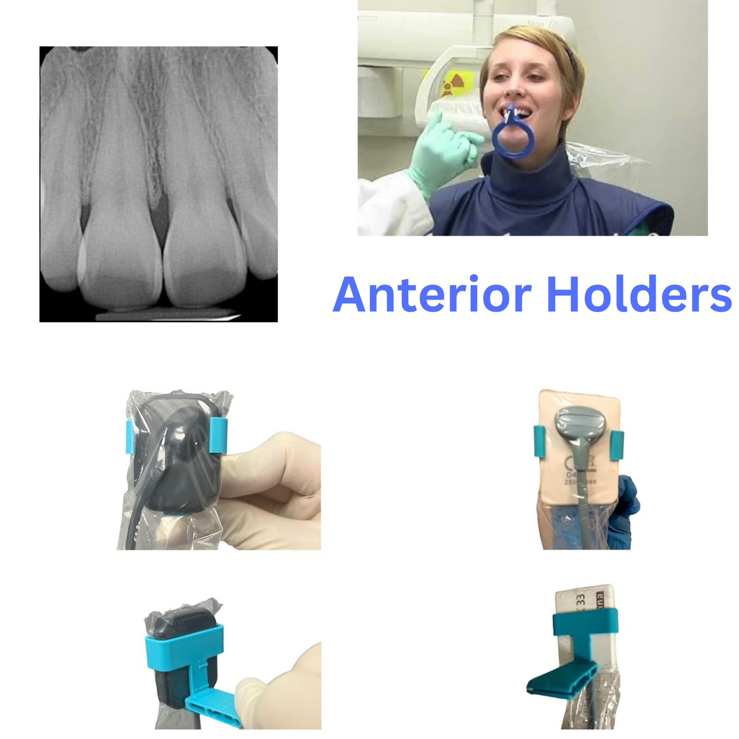 Anterior 4-Pack Holder Kit