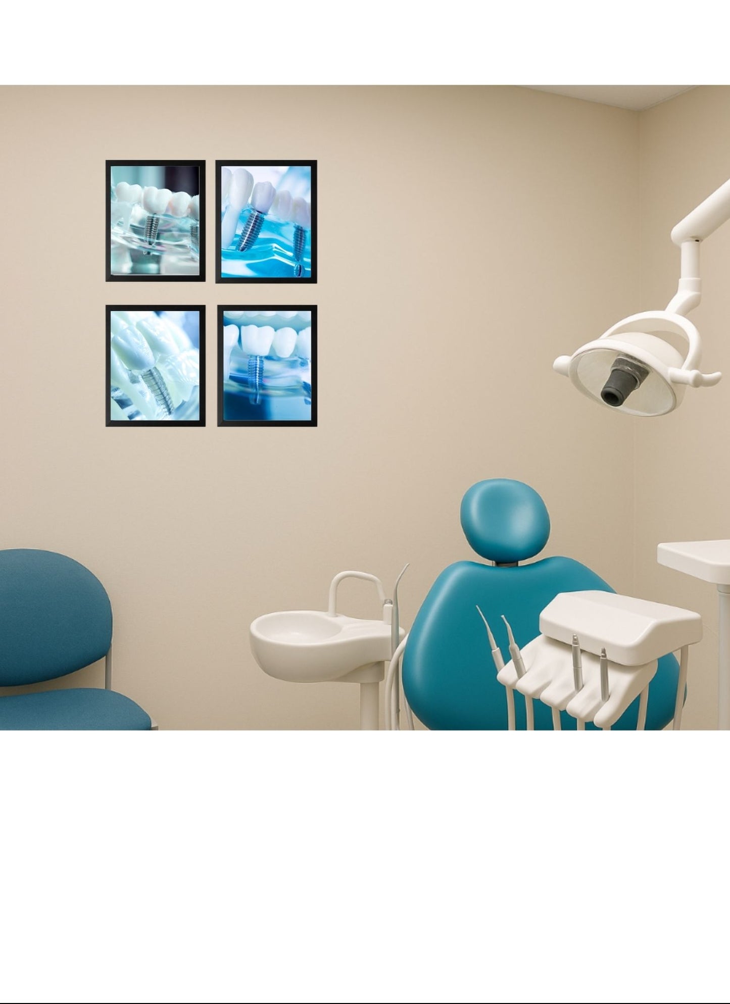 Implant Art Collection – 4-Pack Framed Dental Implant Décor