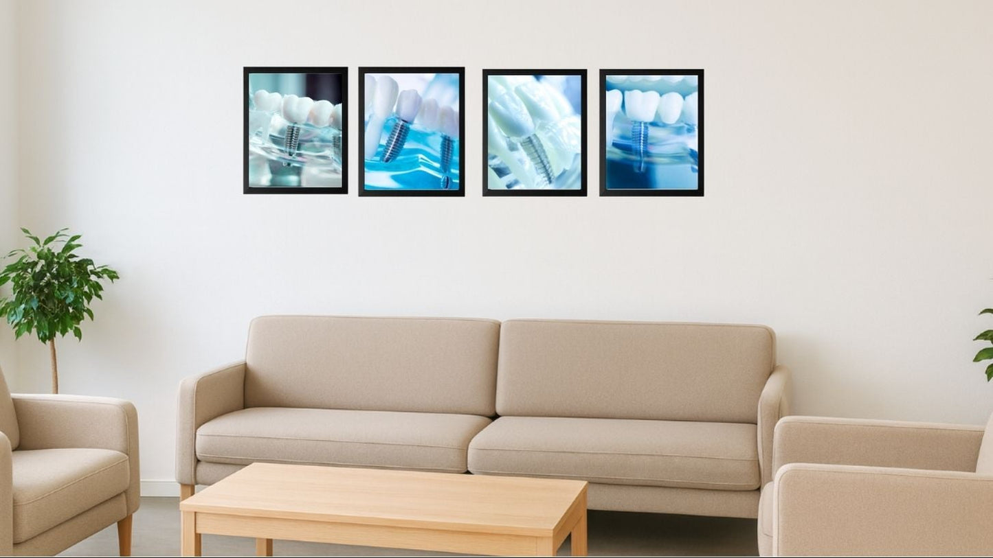 Implant Art Collection – 4-Pack Framed Dental Implant Décor