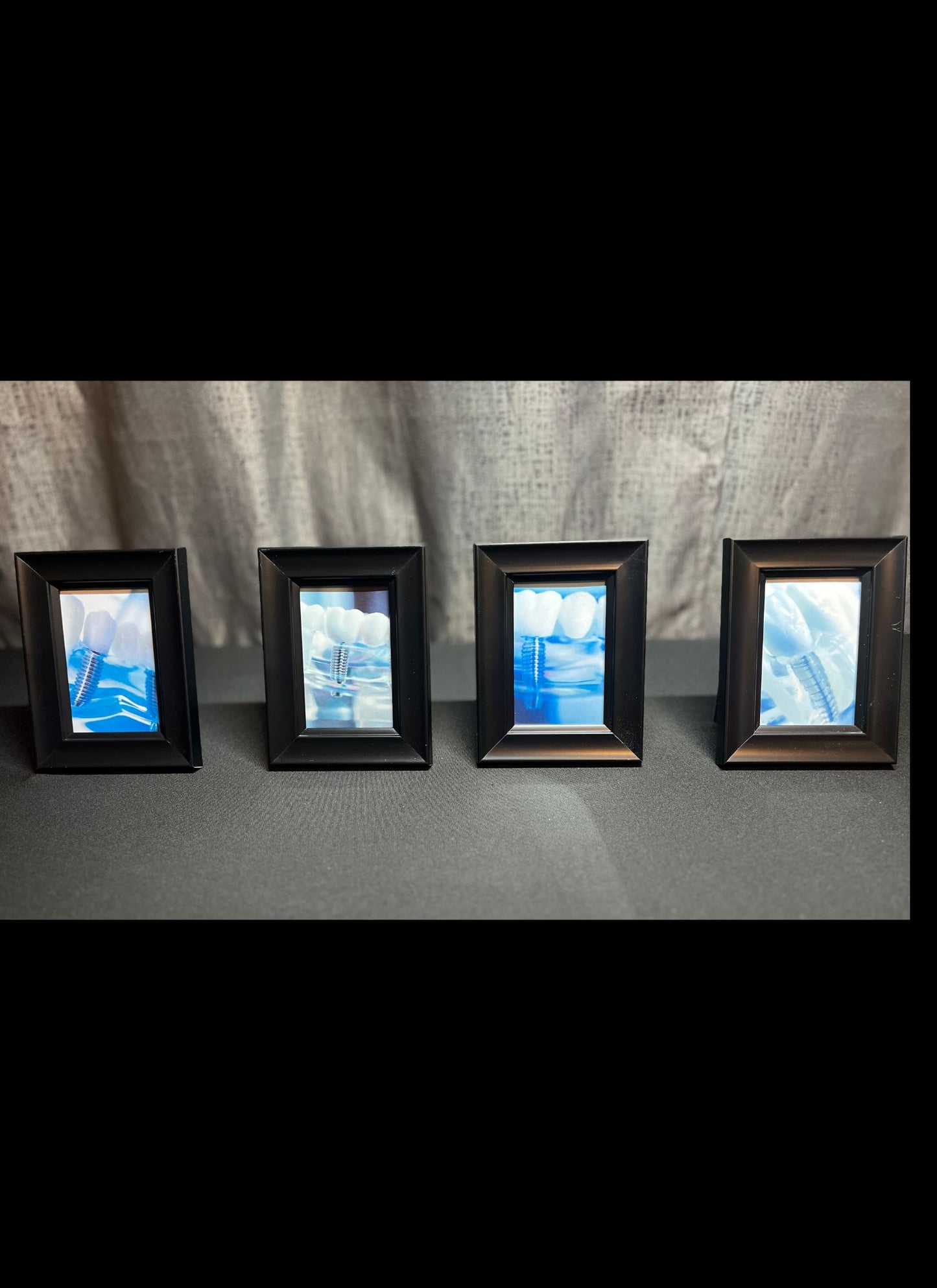 Implant Art Collection – 4-Pack Framed Dental Implant Décor
