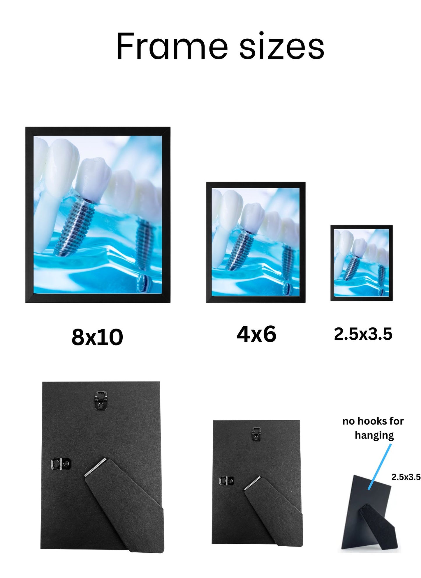 Implant Art Collection – 4-Pack Framed Dental Implant Décor
