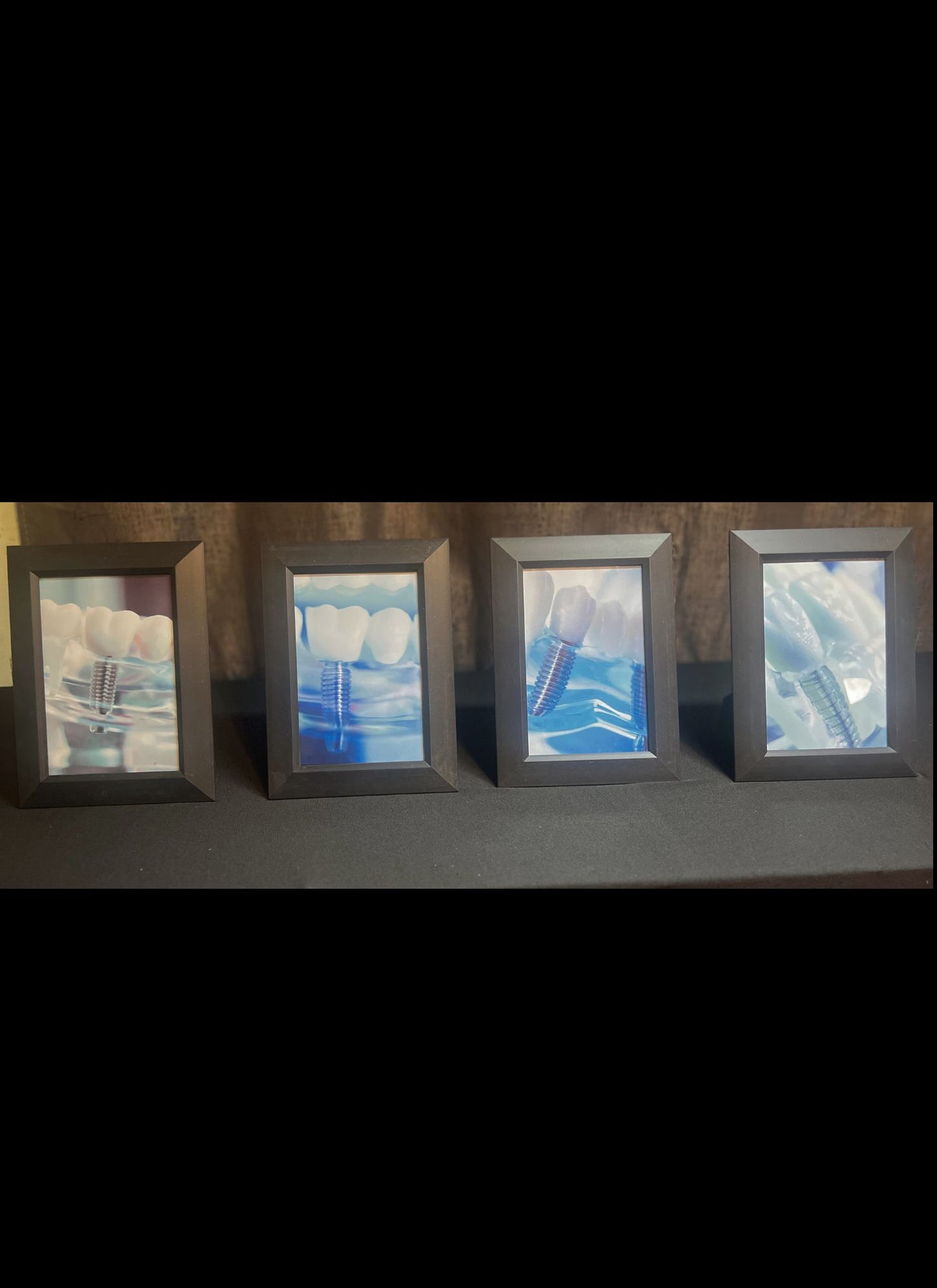 Implant Art Collection – 4-Pack Framed Dental Implant Décor