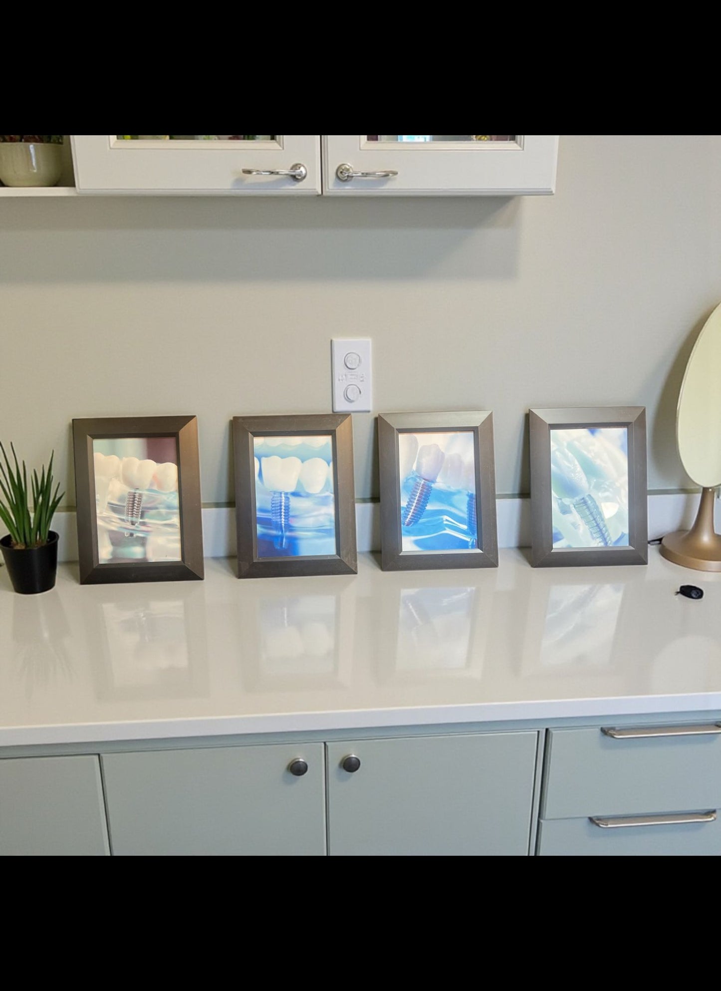 Implant Art Collection – 4-Pack Framed Dental Implant Décor