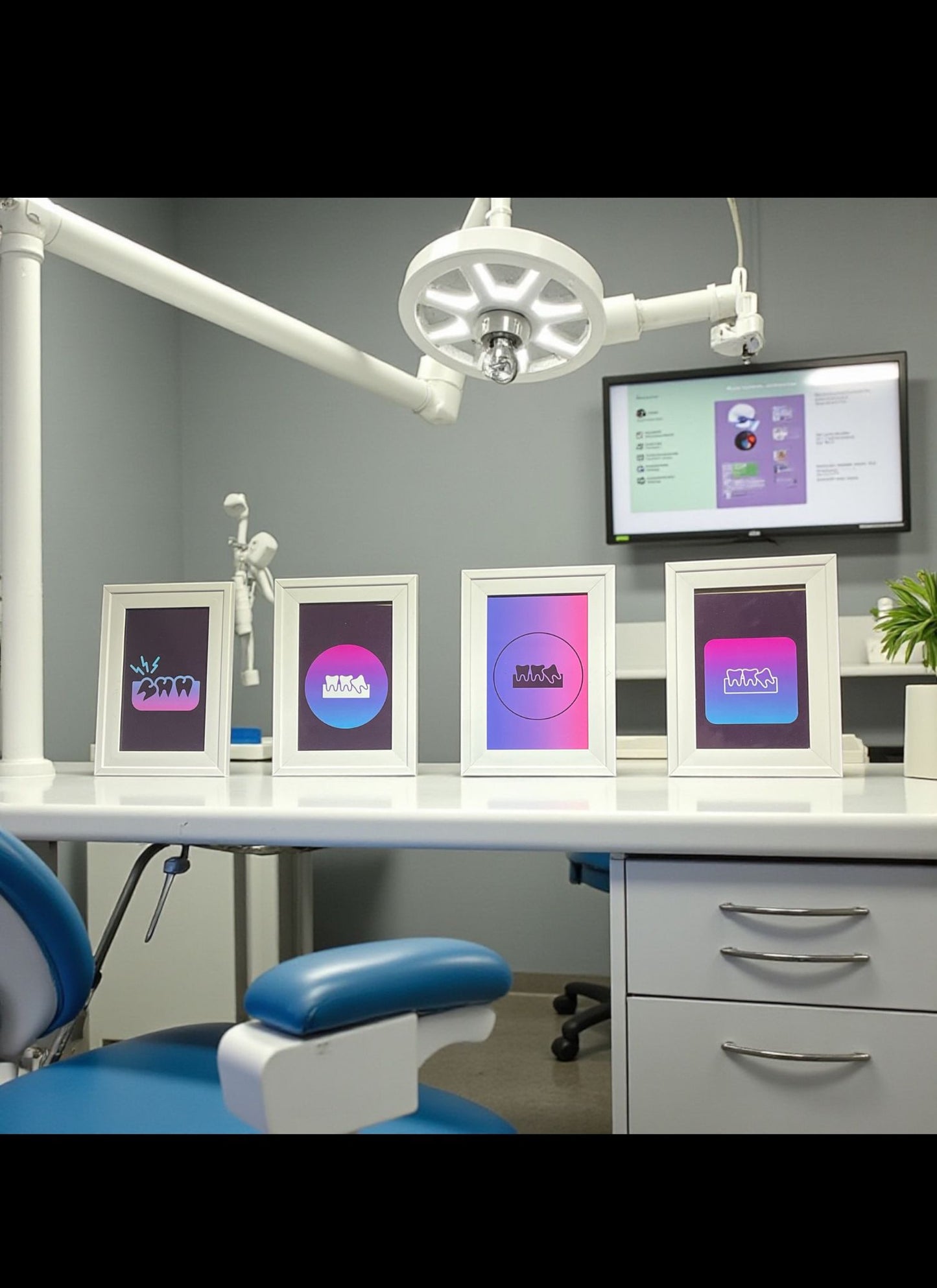 Wisdom Tooth Gradient Art Pack – 4 Framed Prints (Oral Surgery Décor)